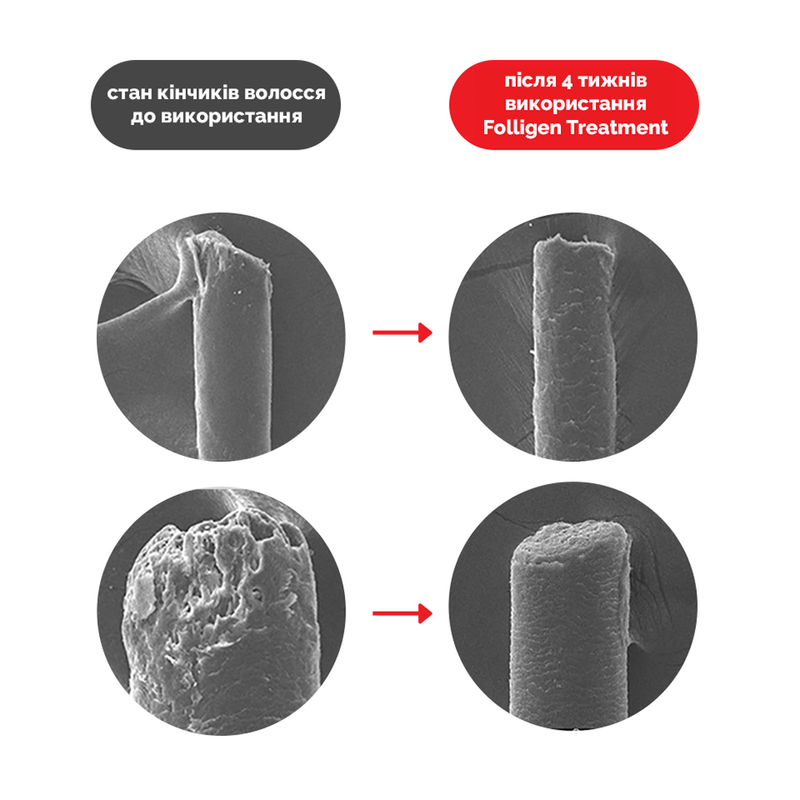 Кондиціонер для волосся Dr.FORHAIR Folligen Treatment, 200 мл 8809485531311 фото