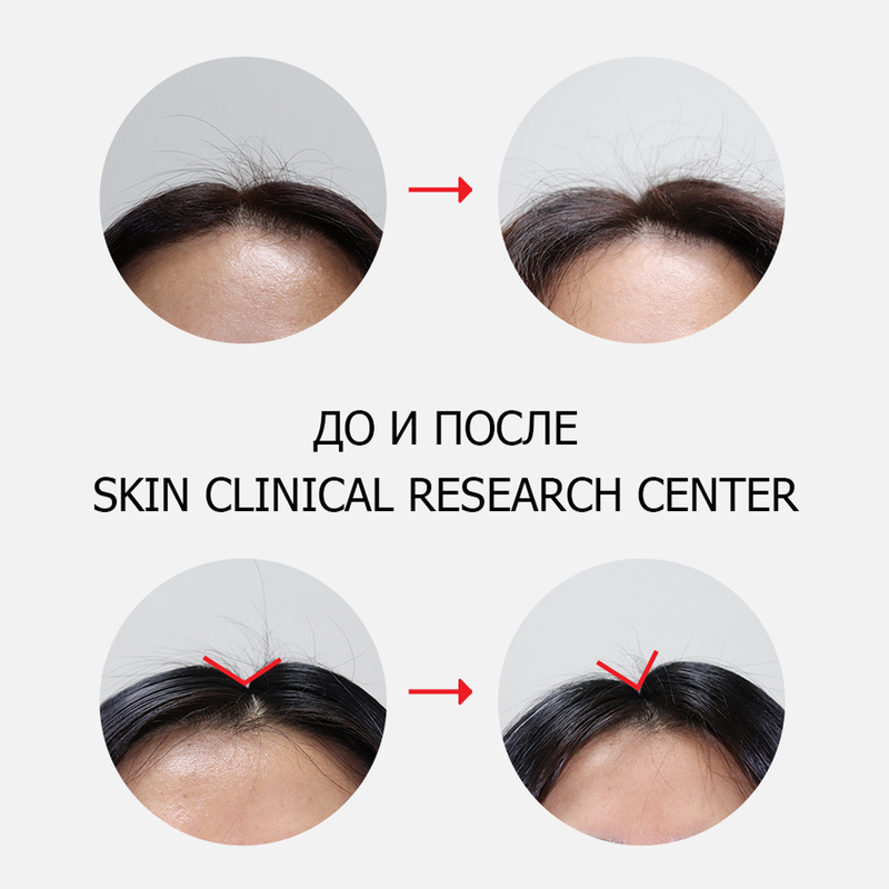 Зміцнюючий шампунь проти випадіння волосся Dr.FORHAIR Folligen Shampoo, 10 мл 8809485531144 фото