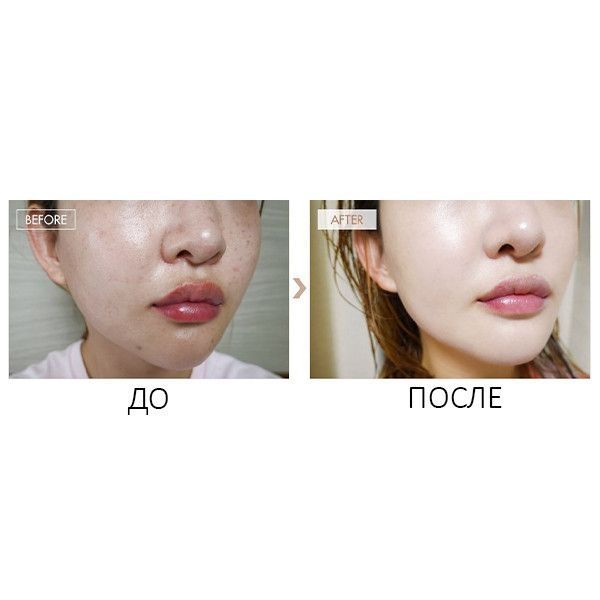 Стійкий ББ крем-бальзам з матовим фінішем Dr.Ceuracle Recovery BB Balm SPF 28 PA ++, 45 мл 8806133613979 фото