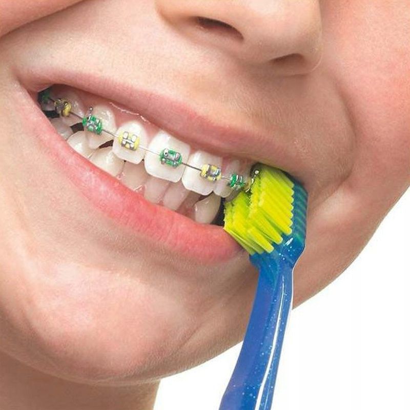 Ортодонтична зубна щітка з заглибленням Curaprox CS 5460 Ortho [Рожевий/Синій], 1 шт 73327179 фото