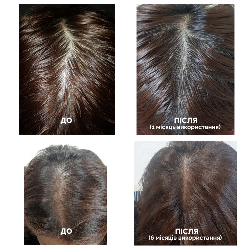 Зміцнюючий шампунь проти випадіння волосся Dr.FORHAIR Folligen Shampoo, 70 мл 8809485532981 фото